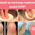 Pozbądź się martwego naskórka ze swoich STÓP!