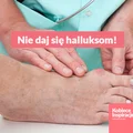Ćwiczenia, które pomogą Ci zapobiec oraz złagodzić haluksy.