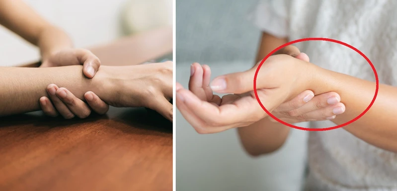 Masz takie znamię na ręce? Nie jesteś jedyna! Już wiadomo, co ono oznacza