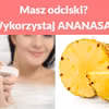 Masz odciski? Wykorzystaj ANANASA!