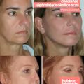 Face Fitness – ćwiczenie ujędrniające okolice oczu. [video]