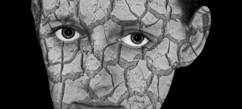 Czas na psychodermatologię?
