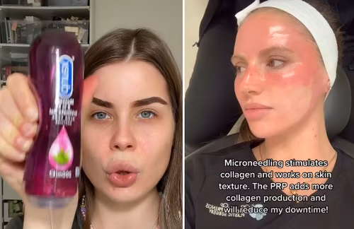 Niebezpieczne trendy z TikToka! Tych urodowych porad nie stosuj