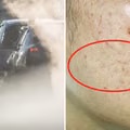 Smog – zobacz, w jaki sposób niszczy cerę!