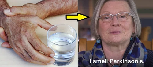 Ta kobieta potrafi wyczuć chorobę parkinsona nosem, zanim do niej dojdzie! Współpracuje z lekarzami