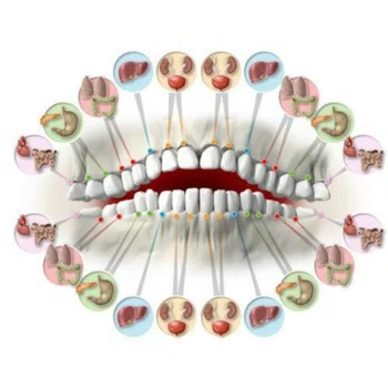 Ból zębów może zwiastować dalsze problemy zdrowotne. Zobacz, co oznacza ból danego zęba