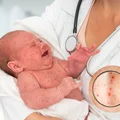 7 chorób, których nie ma dzięki szczepionkom i które wrócą, gdy przestaniemy się szczepić!