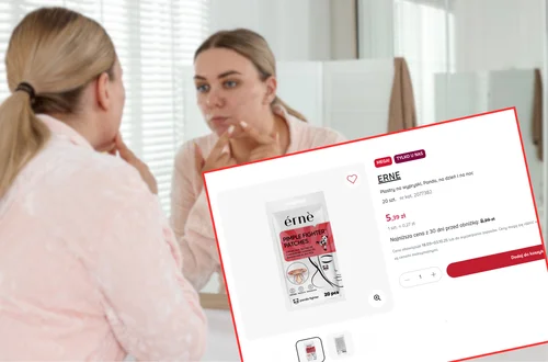 Te plastry na wypryski z Rossmanna za 5,39 zł to totalny hit! Jedna noc i zero pryszczy - uratują skórę w sytuacjach awaryjnych!