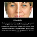 Trik na zmarszczki mimiczne!