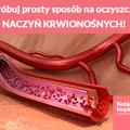 Wypróbuj prosty sposób na oczyszczenie NACZYŃ KRWIONOŚNYCH!