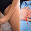Lato może przysparzać nam wiele problemów urodowych. Jak ich uniknąć?