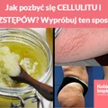 Jak pozbyć się CELLULITU i ROZSTĘPÓW? Wypróbuj ten sposób!
