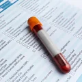 Rewolucja w leczeniu nowotworów i chorób genetycznych!? NFZ wprowadza refundację kluczowych badań!