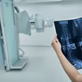 Światowy Dzień Radiologii: Kluczowa Rola Radiologii w Medycynie