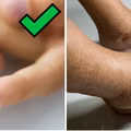 Domowy test na poziom cukru we krwi - kup w aptece. Zadbaj o zdrowie