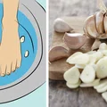 GRZYBICA STÓP? Wykorzystaj czosnek i zrób sobie leczniczą kąpiel!