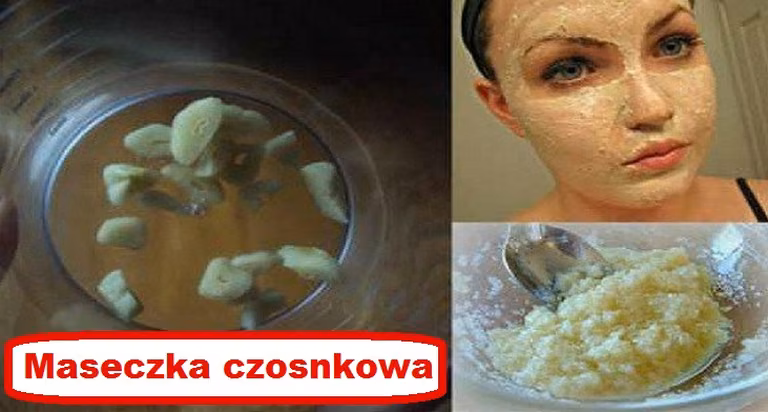 Wypróbuj CZOSNKOWĄ maseczkę która odmłodzi Twoją TWARZ i SZYJĘ!