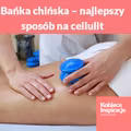 Bańka chińska – najlepszy sposób na cellulit