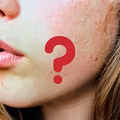 Włoski na brodzie u kobiety? O czym świadczą?