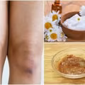 Jak rozjaśnić i wygładzić skórę na kolanach? 3 skuteczne sposoby
