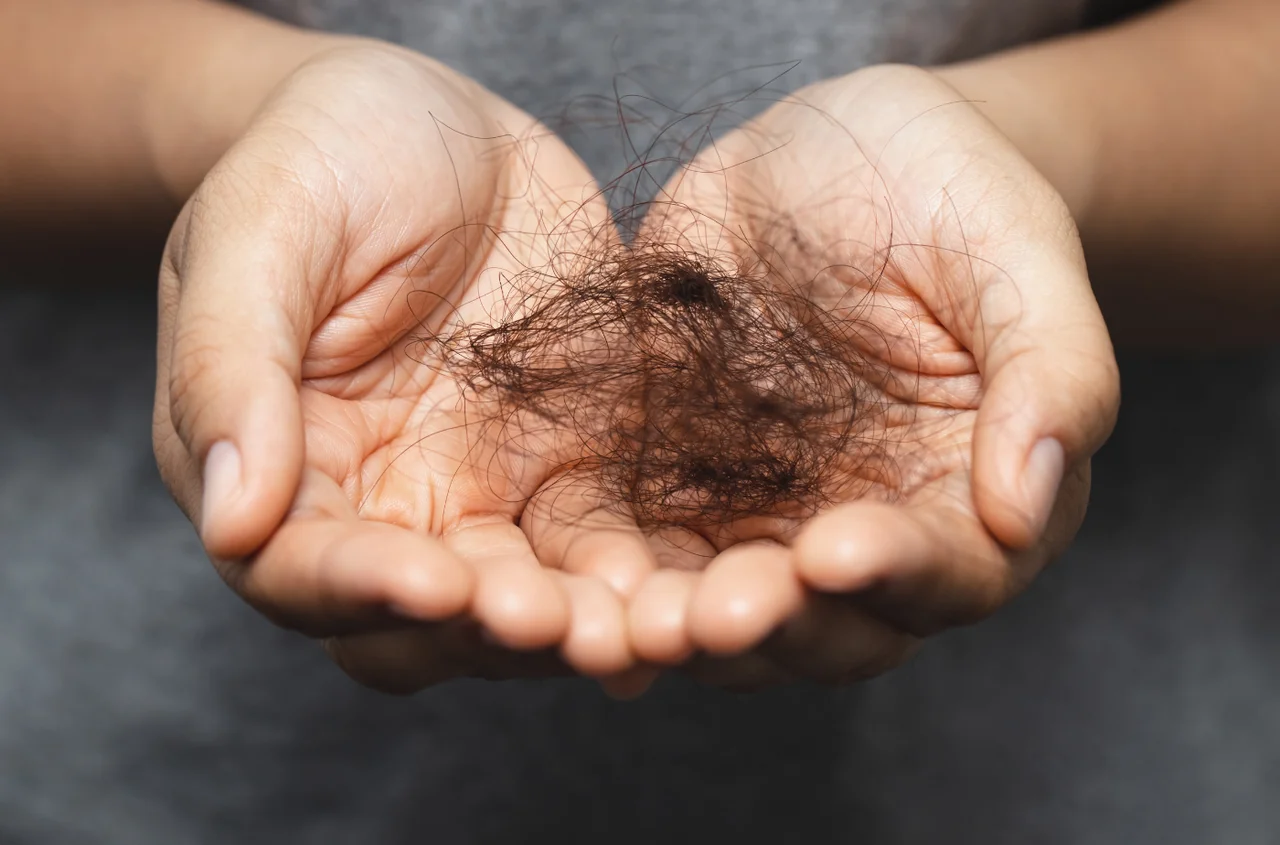 To nie stres powoduje wypadanie włosów najbardziej! Uwaga na ten składnik diety