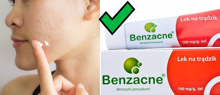 Benzacne - HIT z apteki na zaskórniki za kilkanaście zł!