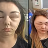 Jedna wizyta u fryzjera sprawiła, że prawie oślepła! Wina fryzjerki?