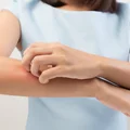 Swędzenie skóry w nocy- co to znaczy?