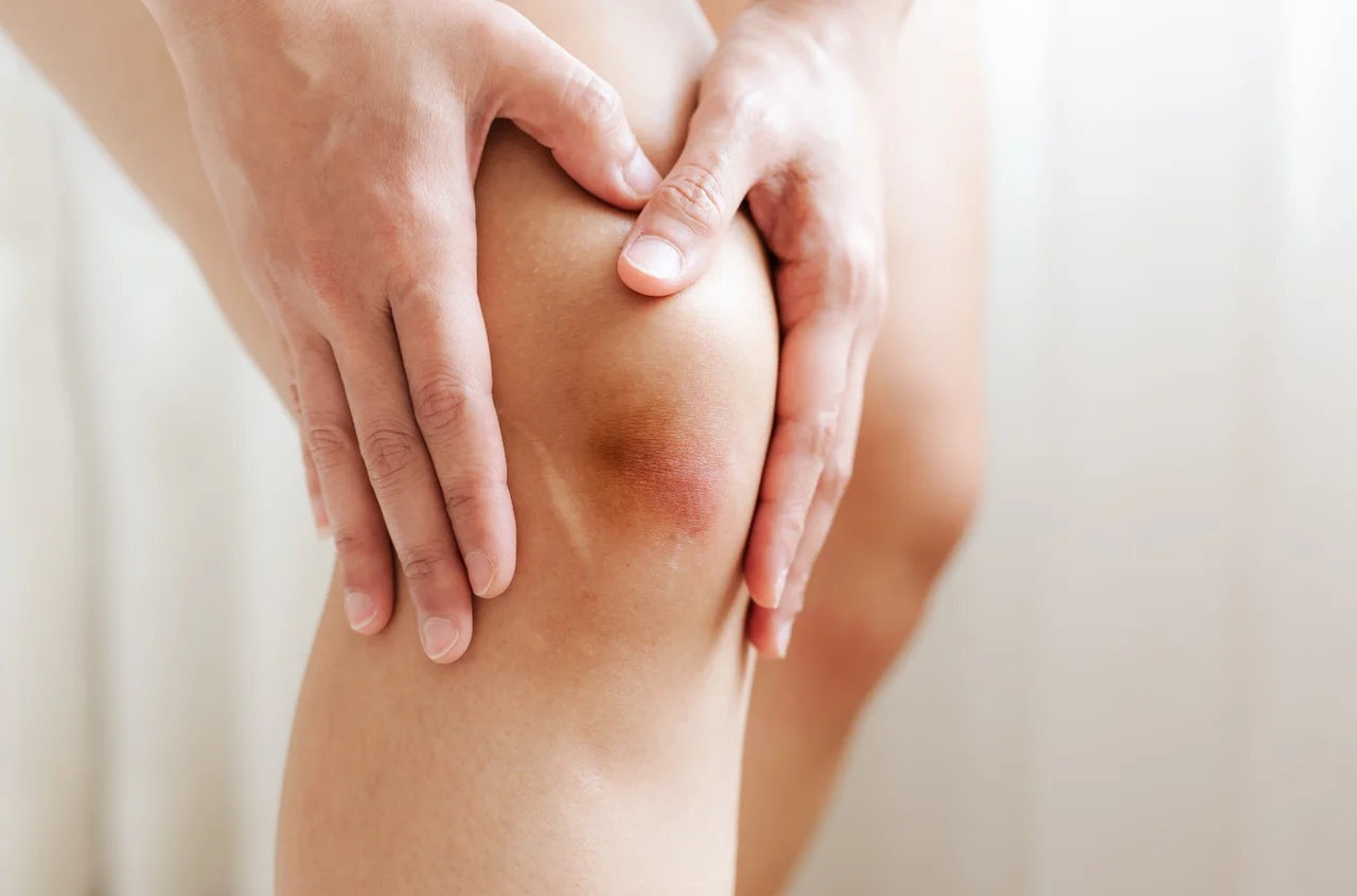 Masz ciemniejszą skórę na łokciach i kolanach? To może być objaw poważnych chorób!