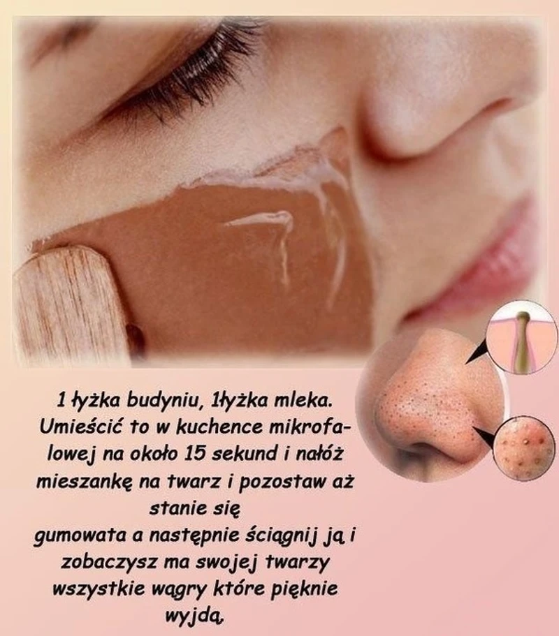 Maseczka na wągry