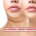 Jak zlikwidować DRUGI PODBRÓDEK?