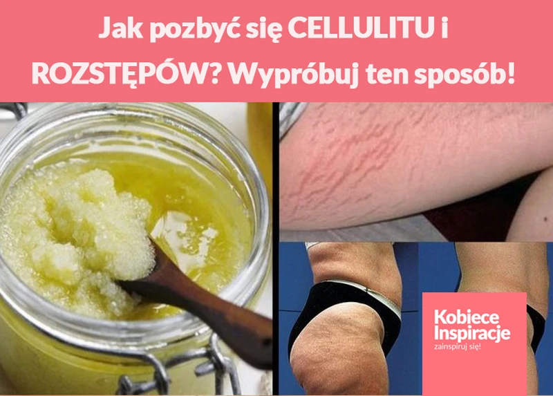 Jak pozbyć się CELLULITU i ROZSTĘPÓW? Wypróbuj ten sposób!