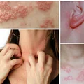 Alergia na biżuterię i ubrania?! Nie bądź zaskoczona!
