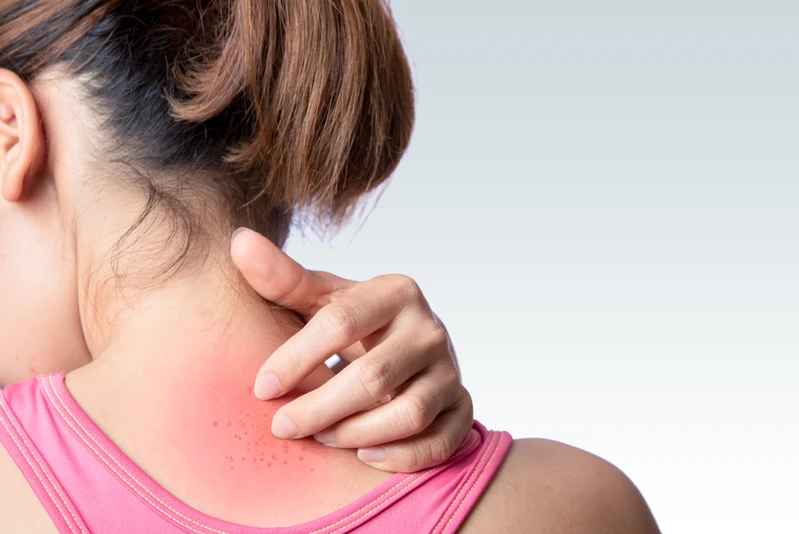 Nowym objawem koronawirusa mogą być zmiany skórne? Francuscy dermatolodzy ostrzegają!