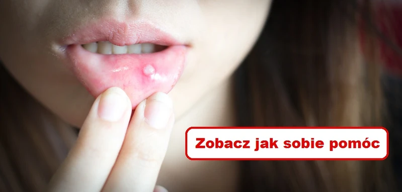 AFTY – domowa kuracja która przynosi ulgę