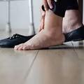 5 chorób, które rozpoznasz po swoich stopach! Na co zwrócić uwagę?