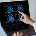 Światowy Dzień Mózgu: Jak Dbać o Zdrowie Naszego Najważniejszego Organ