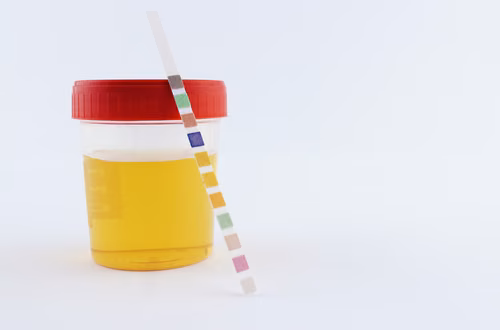 Domowy test z apteki na badanie moczu: Co wykryje? Kto powinien zrobić?