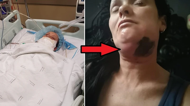 Najpierw bolał ją ząb, chwilę później walczyła o życie. Trwa zbiórka na jej operację