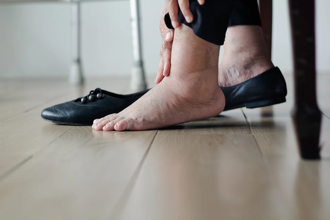 5 chorób, które rozpoznasz po swoich stopach! Na co zwrócić uwagę?