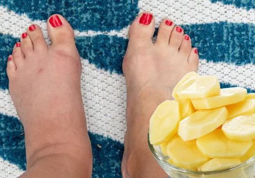 To warzywo to naturalny balsam dla spuchniętych stóp! Efekty widoczne już po godzinie