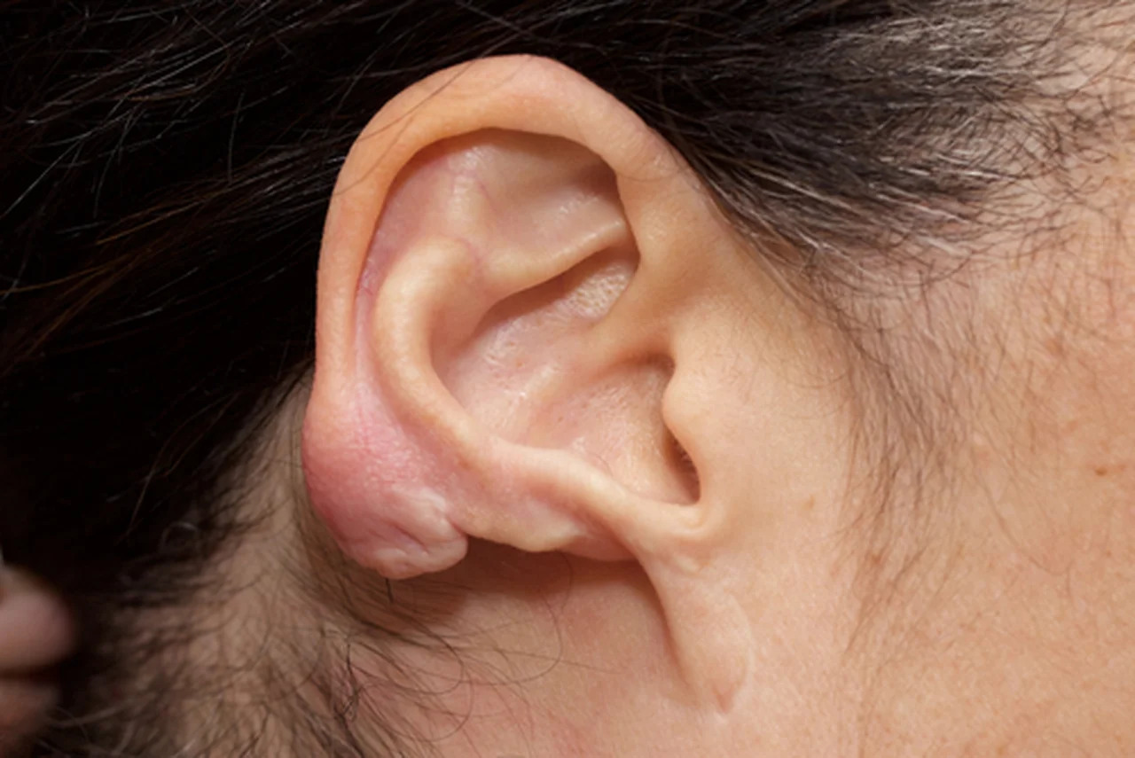 Przekłuwanie uszu dziecku – dlaczego lepiej poczekać z tym zabiegiem?