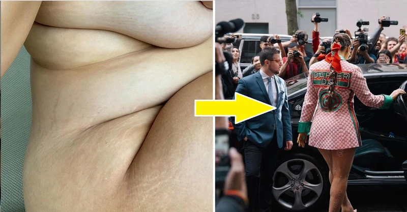Gwiazda w ciąży pokazała swoje rozstępy, a internet oszalał na ich punkcie!