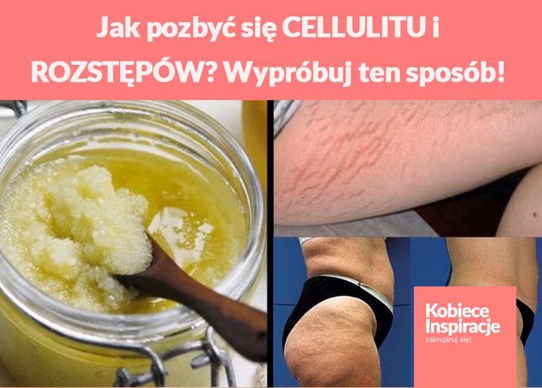 Jak pozbyć się CELLULITU i ROZSTĘPÓW? Wypróbuj ten sposób!