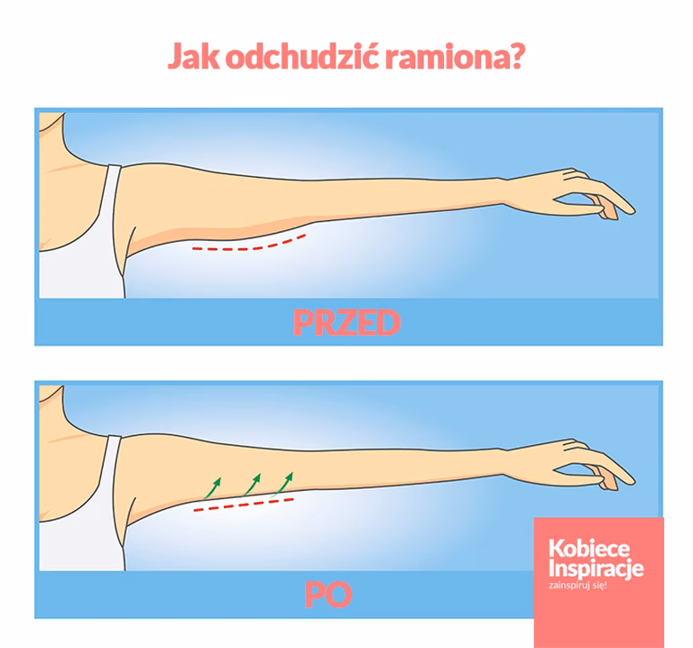 Jak odchudzić ramiona? - zobacz WIDEO z ćwiczeniami