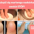 Pozbądź się martwego naskórka ze swoich STÓP!