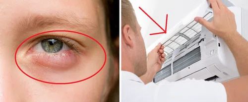 Dlaczego masz opuchnięte oczy? Poznaj 6 możliwych przyczyn