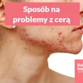 Przewlekły lęk i stres, a problemy z cerą