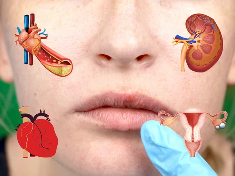 Choroby wypisane na twarzy. Poznaj objawy chorób, które możesz wyczytać z twarzy!