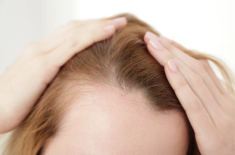 Zakola nie tylko u mężczyzn! Dlaczego kobiety je mają i jak temu zaradzić?